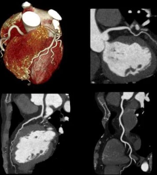 digitalized image of a heart