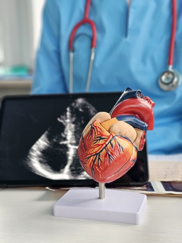 Echocardiogram